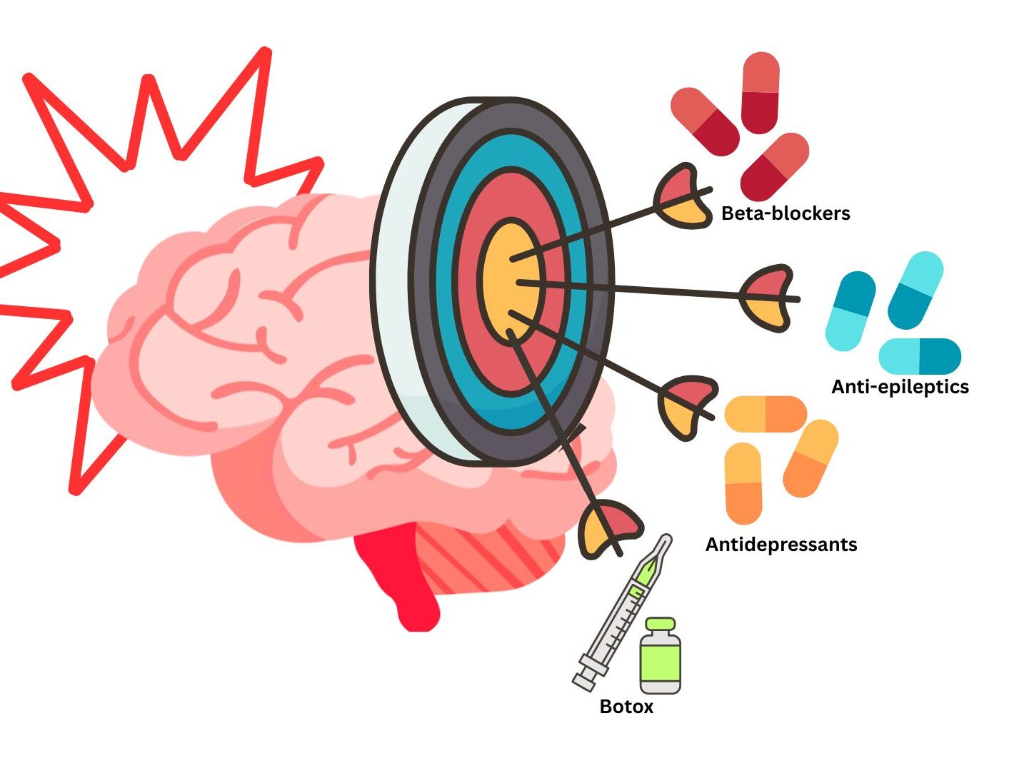From Botox to beta blockers: how medications developed for other health conditions are used in migraine