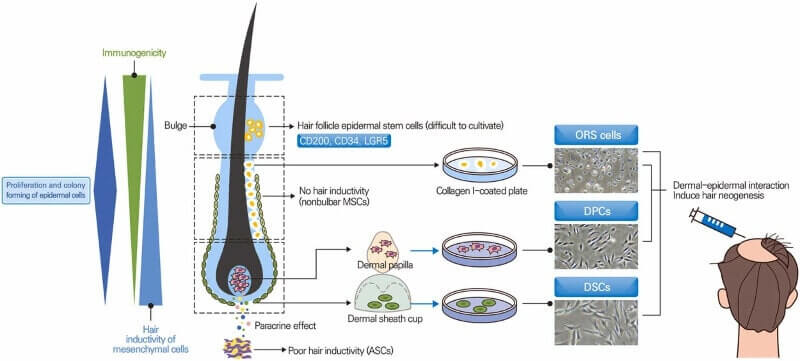 Effective Cell Therapy for Hair Regeneration