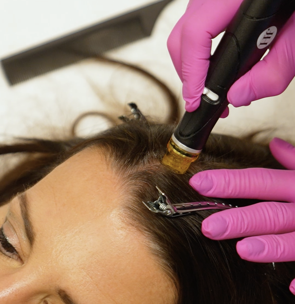 Scalp HydraFacial in Scottsdale: What To Know