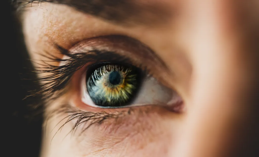 Thyroid Eye Disease: Patient Stories of Diagnosis and Treatment