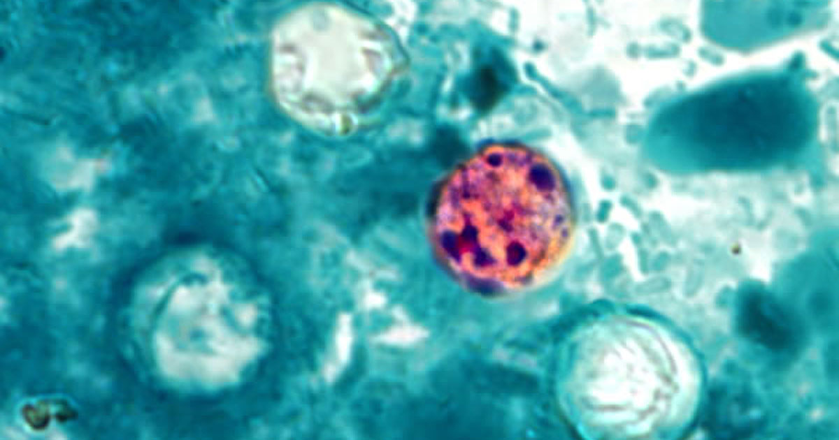 Michigan reports two deaths linked to cyclosporiasis outbreak