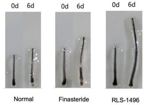 Rubedo Life Sciences RLS-1496 for Hair Loss
