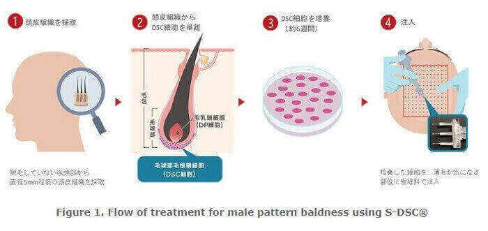 Shiseido DSC Cell Hair Multiplication Procedure is Finally Here