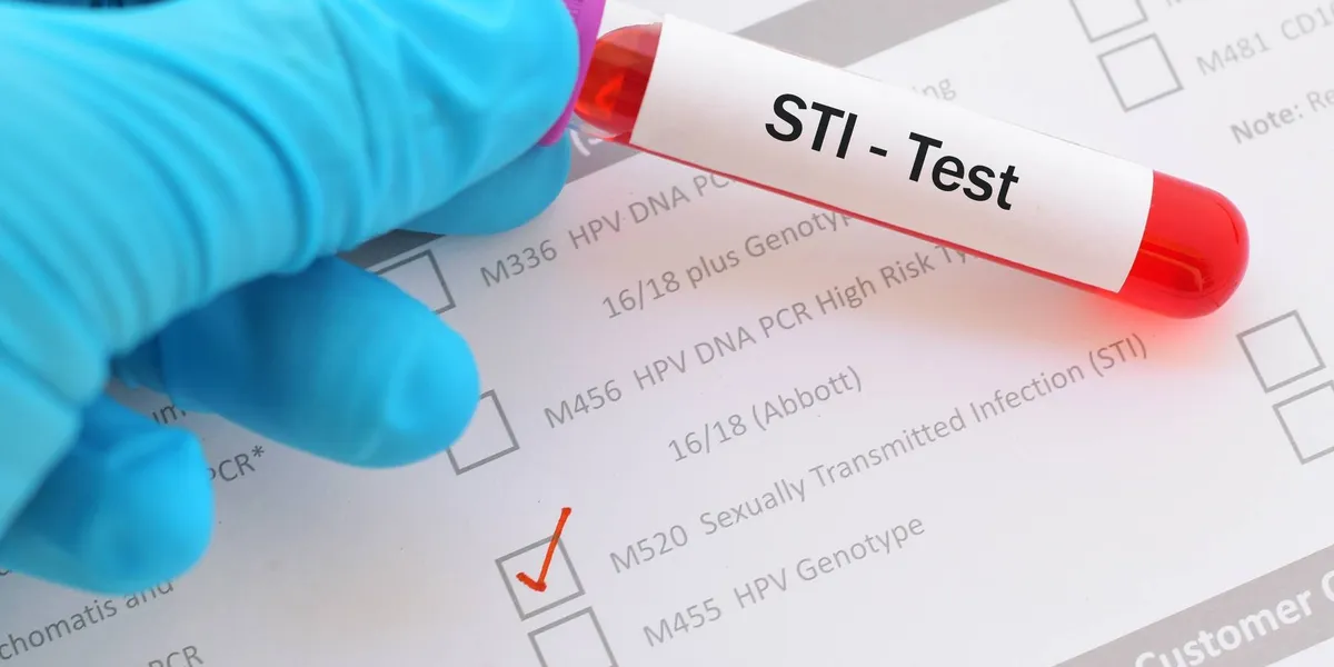 Información comprobada sobre las pruebas para detectar ITS